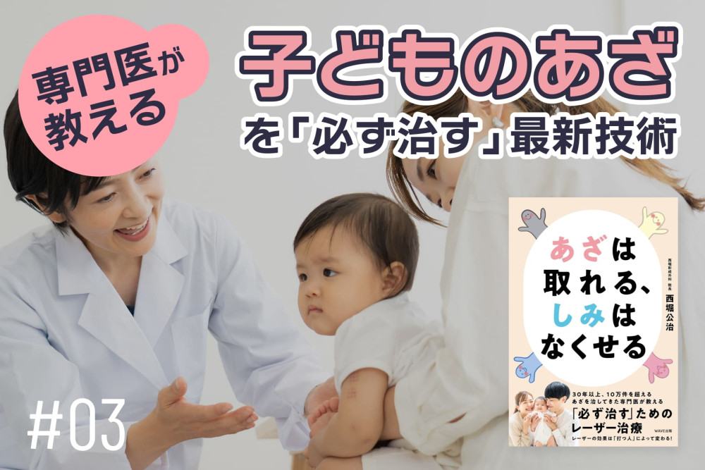 専門医が教える　子どものあざを治療できる最新技術！「なぜ子どものときに早期治療したほうがいいの？」のサムネイル