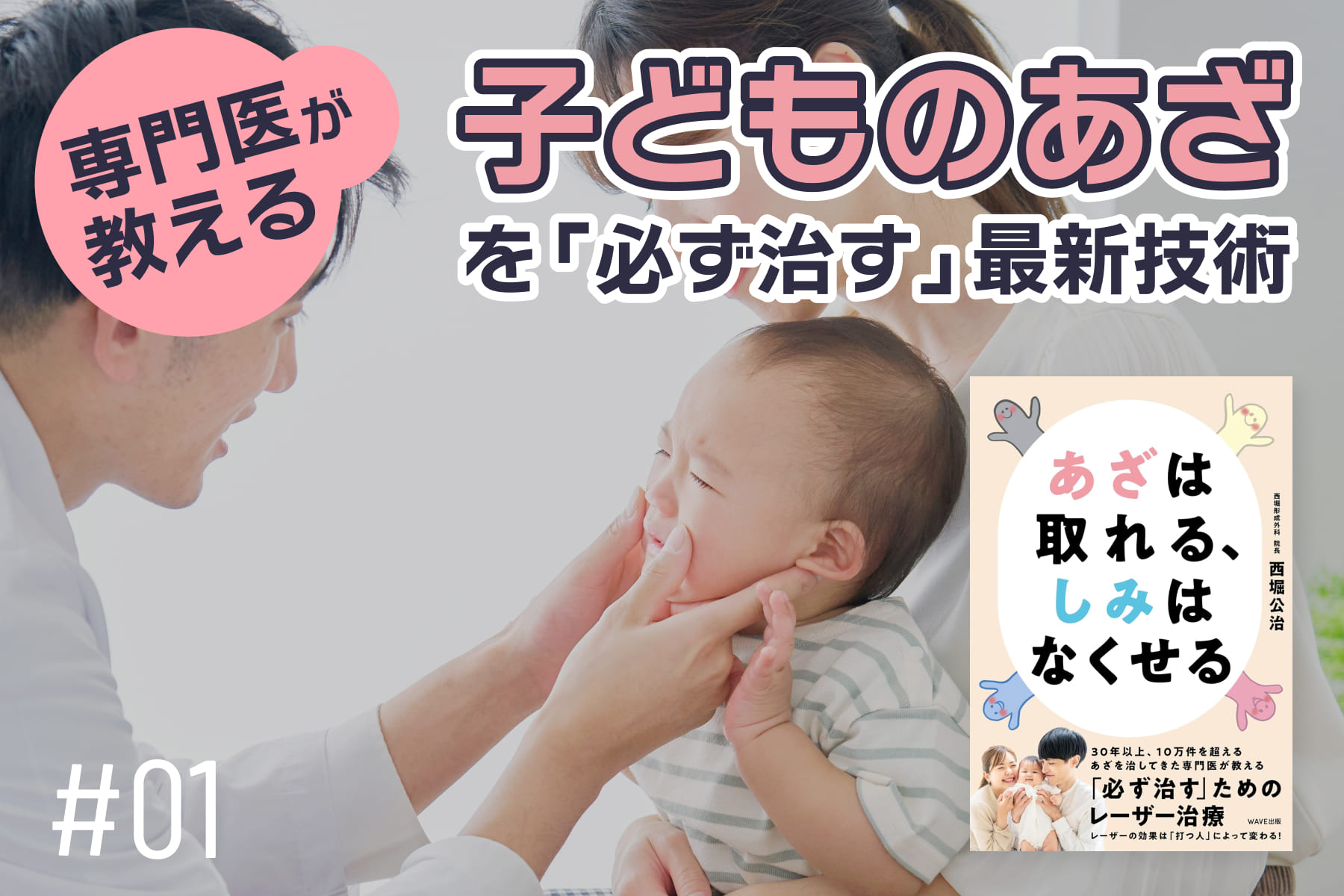専門医が教える　子どものあざを治療できる最新技術！「一日も早くあざの悩みを手放そう」のサムネイル