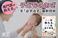 専門医が教える　子どものあざを治療できる最新技術！「一日も早くあざの悩みを手放そう」のサムネイル